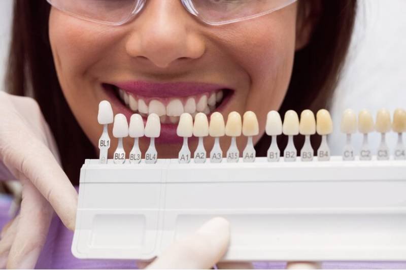 dental bridges