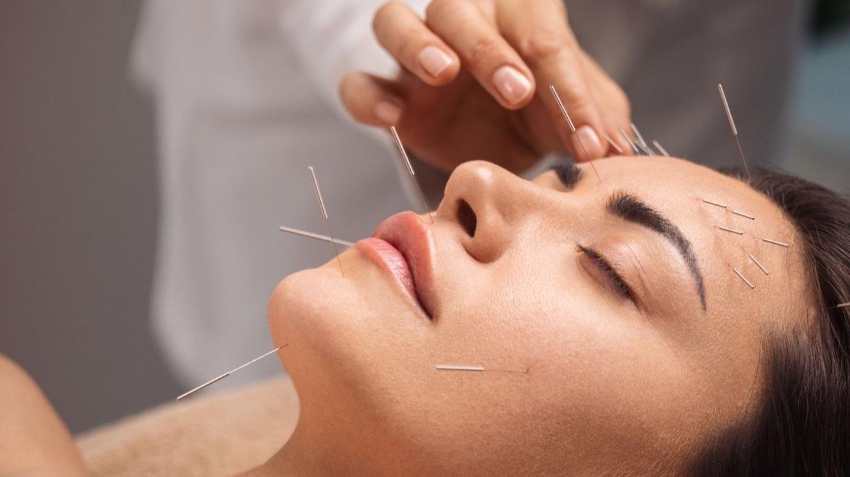 Cosmetic Acupuncture