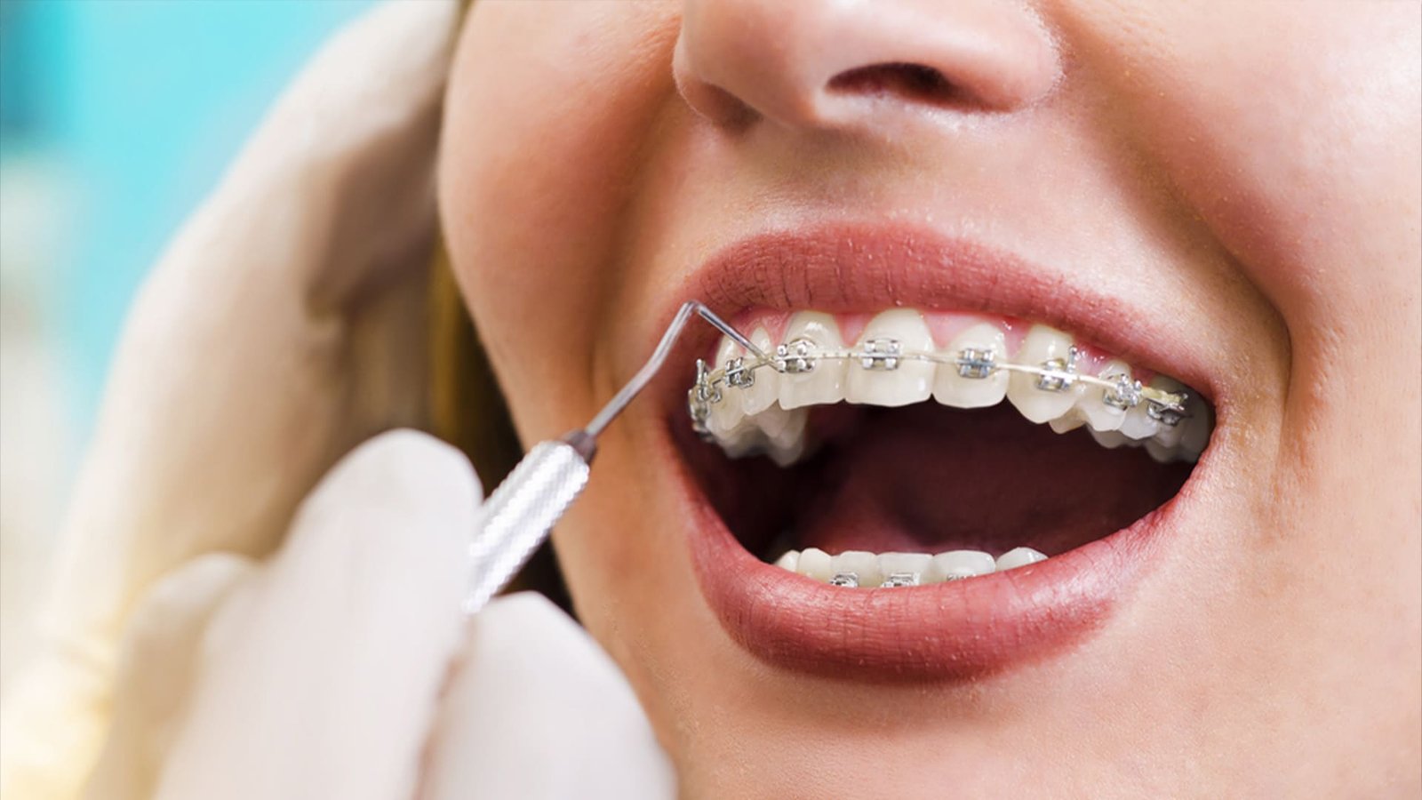 Abu Dhabi orthodontist