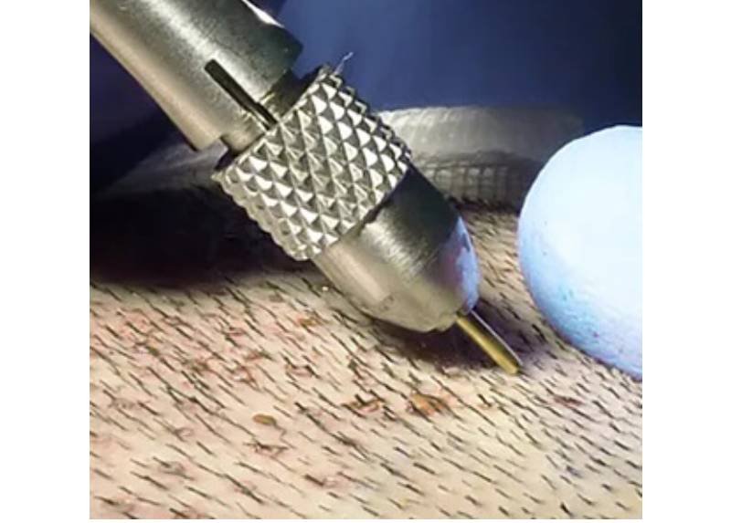 How To Prepare For FUE Hair Transplant In Istanbul?