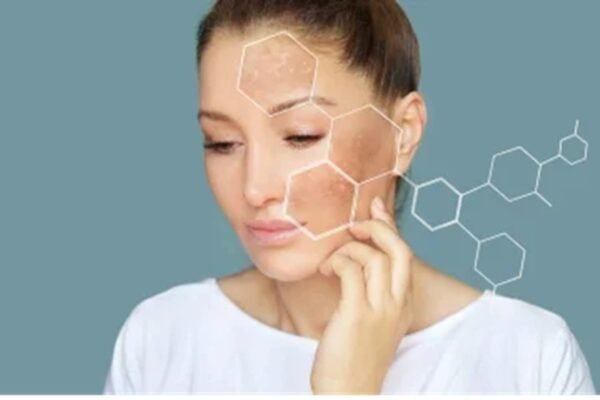 Skin Pigmentation Treatment