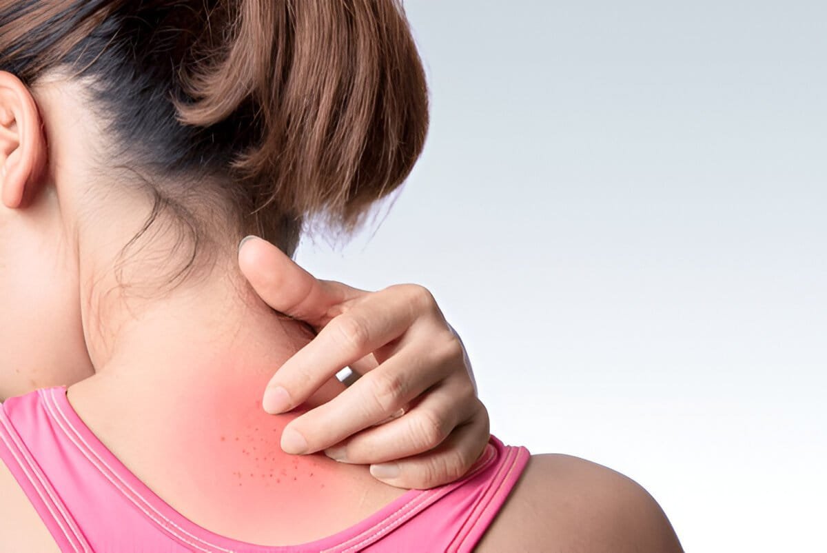 skin doctor in Jaipur