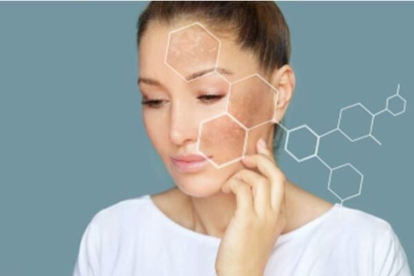 A Promising Solution For Your Pigmentation Worries