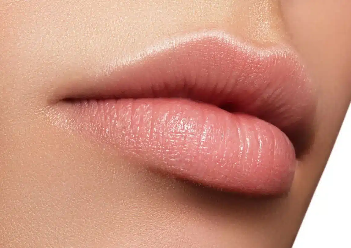 Subtle to Stunning: Lip Filler Transformations in Southsea 1 lip fillers southshields