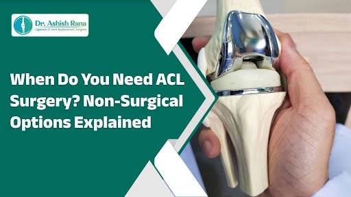 When Do You Need ACL Surgery? Non-Surgical Options Explained