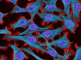 HeLa cells