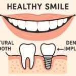 Advancements in Dental Implants: Enhancing Smiles and Oral Health