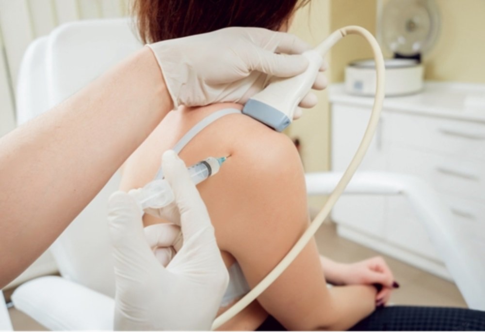 Understanding Frozen Shoulder and Treatment Options in Singapore