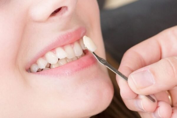 Smile Concerns Solved