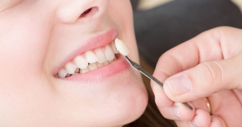 Smile Concerns Solved