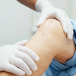 Why Many People Are Choosing Knee Replacement for Long Term Comfort 