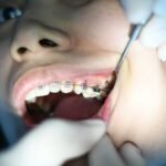 4 Ways Restorative Dentistry Enhances Cosmetic Results