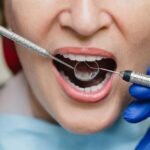 The Link Between Periodontal Care And Diabetes Management