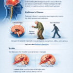 Clinical Neuroanatomy: Common Disorders Linked to Brain and Nervous System Damage