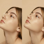 Rhinoplasty vs. Septoplasty: Differences and Benefits in Islamabad