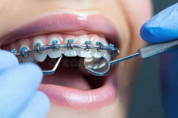 Preventive dentistry supporting successful orthodontic treatment