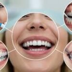 3 Cosmetic Dentistry Options That Deliver Quick Results