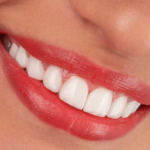 How Cosmetic Dentistry And Med Spa Treatments Create Full Smile Makeovers
