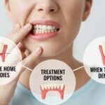 Wisdom Teeth Pain Relief: Home Remedies, Impacted Tooth Solutions & Tampa Treatment Options