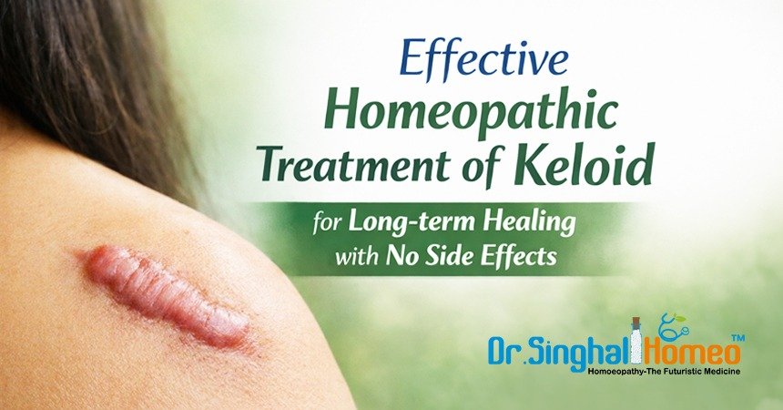 Effective Treatment of Stubborn Keloid Scars in Homeopathy