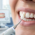 4 Innovations Making Implants More Cosmetic Than Ever