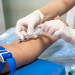 STD Testing Guide: Types, When to Get Tested & Role of IV Drip Therapy