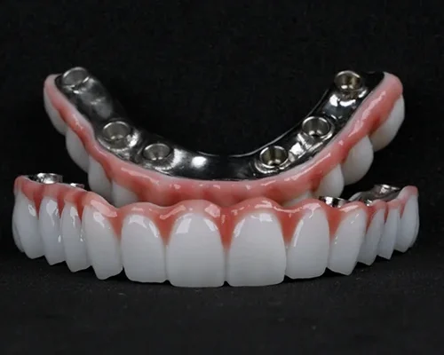All-on-4 and All-on-6 in Turkey Inside DentPrime's Implant Approach