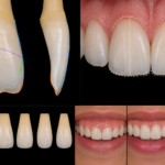 External Crown Anatomy: Form, Contour, and Clinical Significance