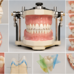 Principles of Ideal Occlusion in Preclinical Dental Education