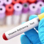 Vitamin Deficiency Test Explained: What Nutrients Are Checked And Why They Matter
