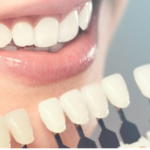 How General Dentistry Helps Manage Gum Health Over Time