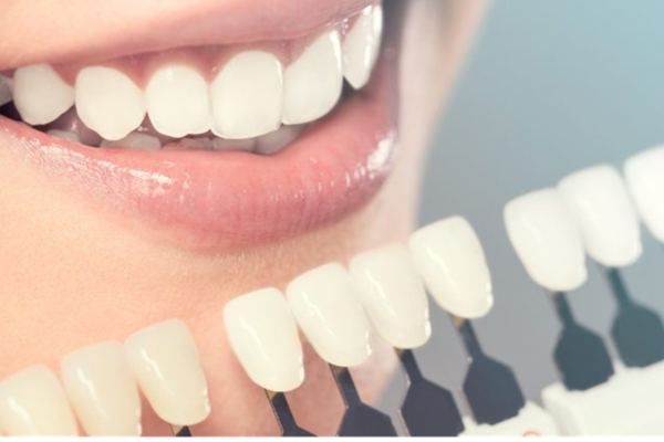 How General Dentistry Helps Manage Gum Health Over Time