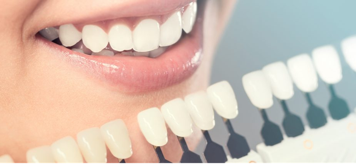 How General Dentistry Helps Manage Gum Health Over Time