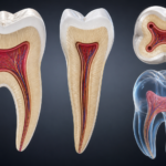 Internal Tooth Anatomy: Pulp Chambers and Root Canal Morphology
