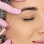 How Bellafill Dermal Filler in Phoenix Fits Into Your Long-Term Anti-Ageing Plan in 2026