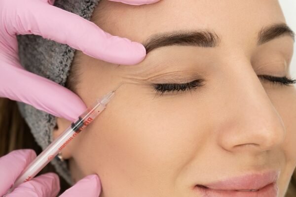 How Bellafill Dermal Filler in Phoenix Fits Into Your Long-Term Anti-Ageing Plan in 2026