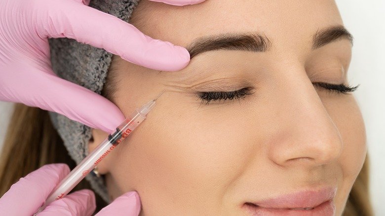 How Bellafill Dermal Filler in Phoenix Fits Into Your Long-Term Anti-Ageing Plan in 2026