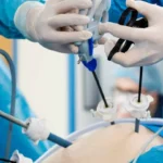 Gall Bladder Surgery in Islamabad – Safe & Advanced Treatment by Dr. Amjad at JJ Medics Hospital
