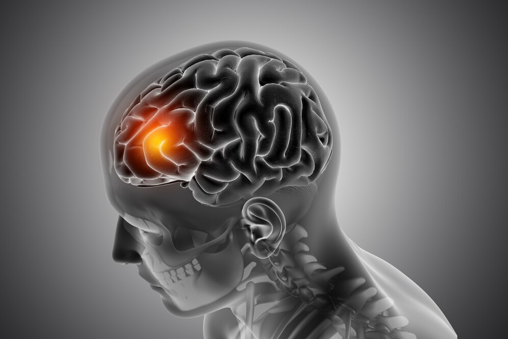 Neurosurgeon Dubai: Trusted Brain and Spine Care with Op. Dr. Fatih Kırar