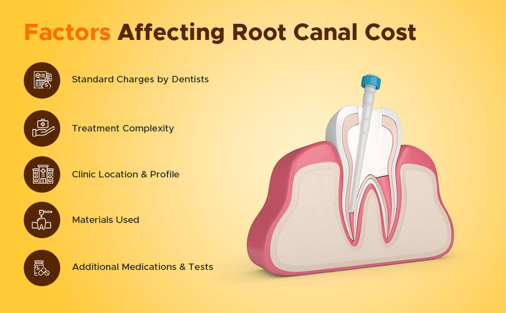 How Much Does Root Canal Treatment Cost? 1 image 439